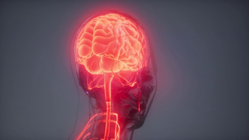 EP 04 - Cerebral Stroke | Ramadan and Fasting