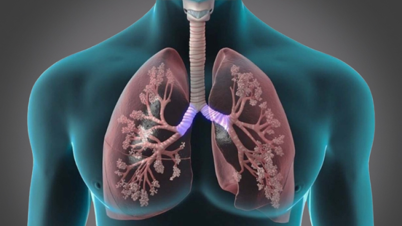 EP 11 - Asthma | Ramadan and Fasting