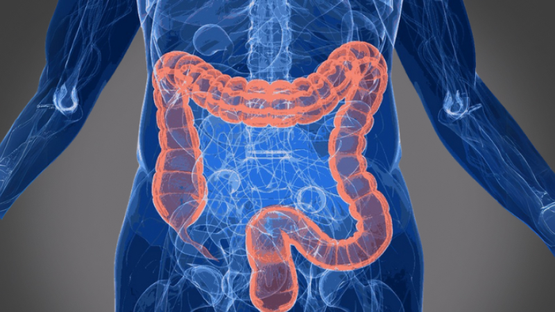 EP 19 - Irritable Bowel Syndrome | Ramadan and Fasting