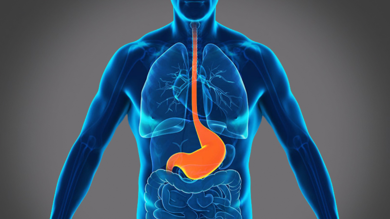 EP 26 - Heartburn | Ramadan and Fasting