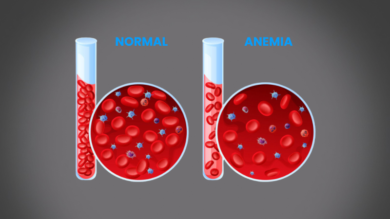 EP 30 - Anemia | Ramadan and Fasting